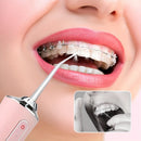 Irrigador Dental Portátil Pro™ - Limpieza Interdental Profunda (USB)